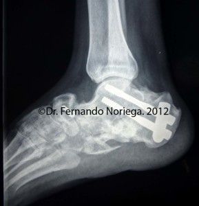 ER5 copia