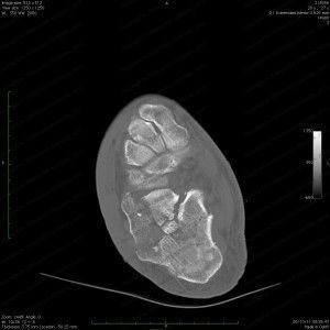 0001-2POST_new-300x300-300x300