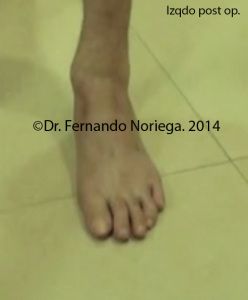 GB2 copia