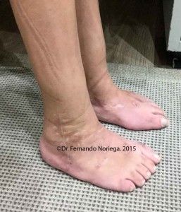 IBO POST 8 copia
