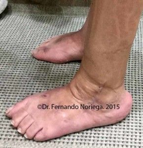 IBO POST 9 copia