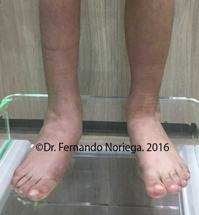 POSTHUGO2